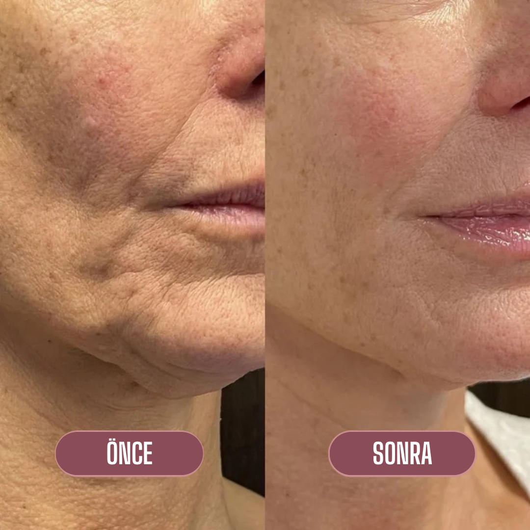 Lakerain™ Collagen Multi Balm