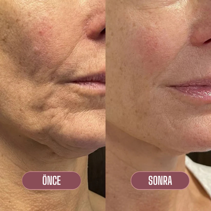 Lakerain™ Collagen Multi Balm